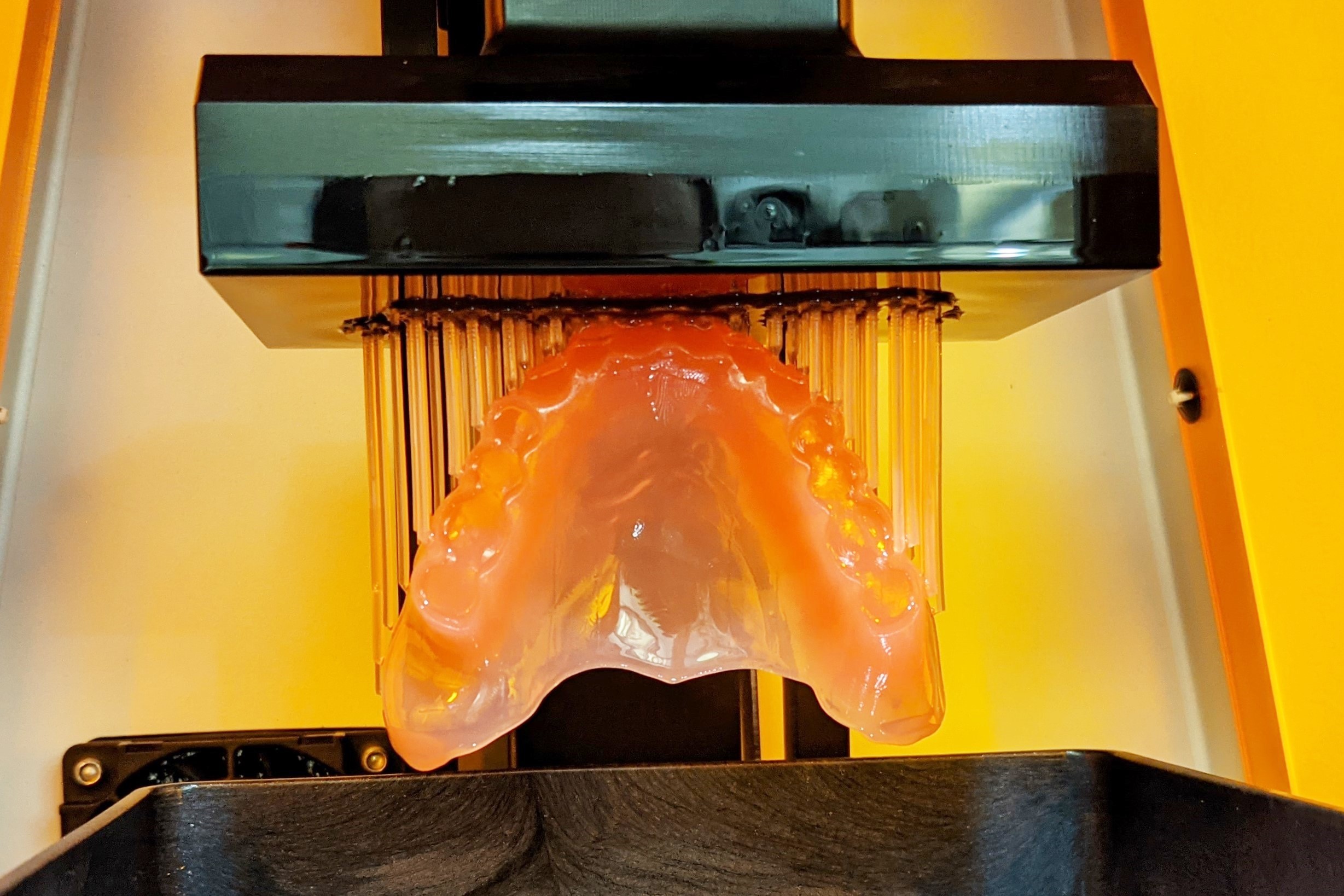 3Dプリンターで歯茎をつくる様子　出典：お守り入れ歯社